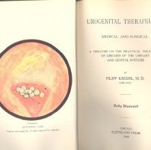 Urogenital therapeutics medical and surgical : a treatise on the practical treatment of diseases of the urinary and genital systems